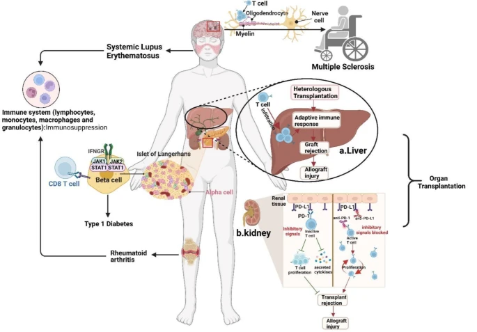 PD-1+PD-L1 在移植和自身免疫性疾病中的作用.png
